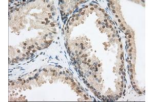 Immunohistochemical staining of paraffin-embedded Human Kidney tissue using anti-PDE4A mouse monoclonal antibody. (PDE4A antibody)