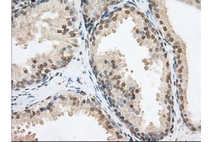 Immunohistochemical staining of paraffin-embedded Human Kidney tissue using anti-PDE4A mouse monoclonal antibody.