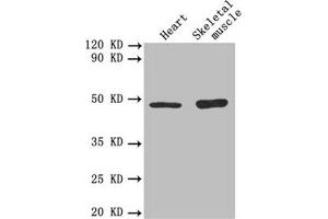 Western blot All lanes: TGFB2 antibody at 3 μg/mL Lane 1: Mouse heart tissue Lane 2: Mouse skeletal muscle tissue Secondary Goat polyclonal to rabbit IgG at 1/10000 dilution Predicted band size: 48, 51 kDa Observed band size: 48 kDa (TGFB2 antibody  (AA 304-413))