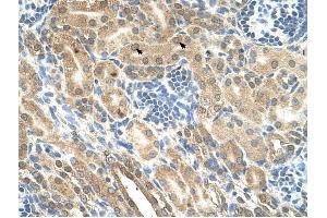 IHH antibody was used for immunohistochemistry at a concentration of 4-8 ug/ml to stain Epithelial cells of renal tubule (arrows) in Human Kidney. (Indian Hedgehog antibody)