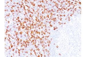 Formalin-fixed, paraffin-embedded human Tonsil stained with CD8A Mouse Monoclonal Antibody (C8/144B). (CD8 alpha antibody  (C-Term, Cytoplasmic Domain))