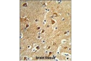 Formalin-fixed and paraffin-embedded human brain tissue reacted with M1H Antibody (Center), which was peroxidase-conjugated to the secondary antibody, followed by DAB staining. (PPM1H antibody  (AA 235-263))