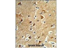 Formalin-fixed and paraffin-embedded human brain tissue reacted with M1H Antibody (Center), which was peroxidase-conjugated to the secondary antibody, followed by DAB staining. (PPM1H antibody  (AA 235-263))