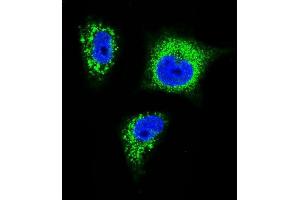 Confocal immunofluorescent analysis of TrkA Antibody f with MDA-M cell followed by Alexa Fluor 488-conjugated goat anti-rabbit lgG (green).