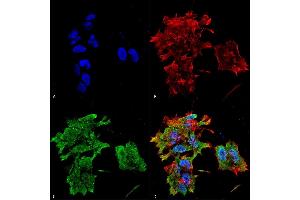 Immunocytochemistry/Immunofluorescence analysis using Mouse Anti-Alpha B Crystallin Monoclonal Antibody, Clone 3A10. (CRYAB antibody  (Atto 594))