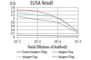 Black line: Control Antigen (100 ng),Purple line: Antigen (10 ng), Blue line: Antigen (50 ng), Red line:Antigen (100 ng) (GRIK5 antibody  (AA 21-166))