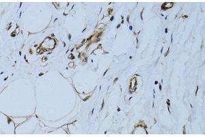 Immunohistochemistry (Paraffin-embedded Sections) (IHC (p)) image for anti-Melanoma Cell Adhesion Molecule (MCAM) antibody (ABIN7257483)