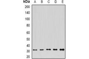 Western blot analysis of FGFBP1 expression in A549 (A), HepG2 (B), NIH3T3 (C), mouse kidney (D), rat brain (E) whole cell lysates. (FGFBP1 antibody)