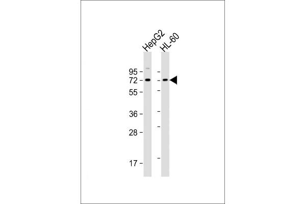 PIAS3 anticorps  (N-Term)