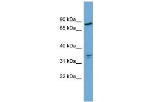 WB Suggested Anti-APEH Antibody Titration:  0. (APEH antibody  (Middle Region))