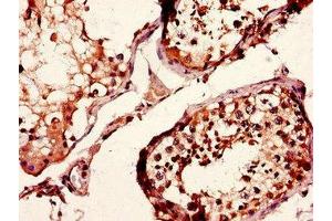 Immunohistochemistry of paraffin-embedded human testis tissue using ABIN7158234 at dilution of 1:100