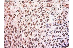 Image no. 11 for anti-Myc Proto-Oncogene protein (MYC) antibody (ABIN1497011) (c-MYC antibody)