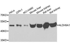 Western blot analysis of extracts of various cell lines, using ALDH9A1 antibody. (ALDH9A1 antibody)