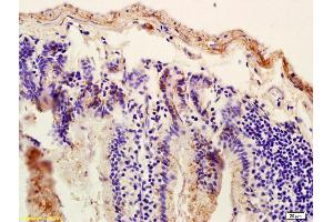 Formalin-fixed and paraffin embedded mouse intestine labeled with Anti-SUR1 Polyclonal Antibody, Unconjugated (ABIN701980) at 1:200, followed by conjugation to the secondary antibody and DAB staining (ABCC8 antibody  (AA 301-400))