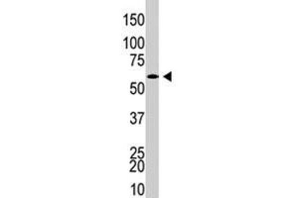 USP21 antibody  (AA 406-436)