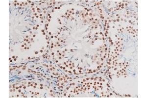 Immunohistochemistry (IHC) image for anti-Nuclear Factor-kB p65 (NFkBP65) (pThr435) antibody (ABIN6255688)