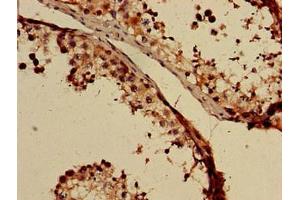 Immunohistochemistry of paraffin-embedded human testis tissue using ABIN7153497 at dilution of 1:100 (GABRB3 antibody  (AA 328-450))