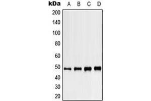 Western blot analysis of Kir3. (KCNJ5 antibody  (C-Term))