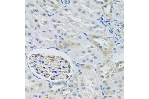 Immunohistochemistry of paraffin-embedded rat kidney using SLC29A1 antibody (ABIN6293826) at dilution of 1:100 (40x lens). (SLC29A1 antibody)