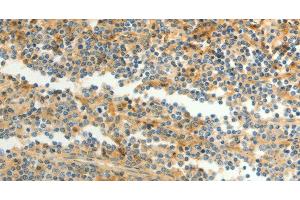 Immunohistochemistry of paraffin-embedded Human tonsil using CFHR1 Polyclonal Antibody at dilution of 1:40 (CFHR1 antibody)