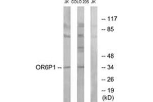 Western blot analysis of extracts from Jurkat/COLO cells, using OR6P1 Antibody. (OR6P1 antibody  (AA 160-209))