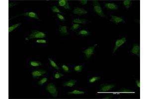Immunofluorescence of monoclonal antibody to PRKRIP1 on HeLa cell. (PRKRIP1 antibody  (AA 1-184))