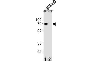 Western Blotting (WB) image for anti-Ets Variant 5 (ETV5) antibody (ABIN2995808)