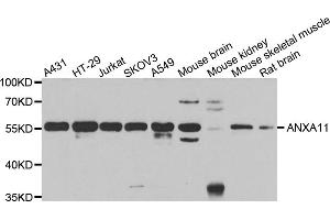 Western blot analysis of extracts of various cell lines, using ANXA11 antibody (ABIN5975523) at 1/1000 dilution. (Annexin A11 antibody)