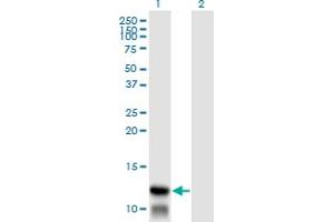 Western Blotting (WB) image for anti-Translocase of Inner Mitochondrial Membrane 8A (TIMM8A) (AA 9-98) antibody (ABIN598643) (TIMM8A/DDP antibody  (AA 9-98))