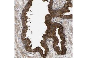 Immunohistochemical staining of human prostate with KRTAP27-1 polyclonal antibody  strong cytoplasmic positivity in glandular cells at 1:200-1:500 dilution. (KRTAP27-1 antibody)