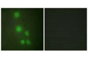Immunofluorescence analysis of HUVEC cells, using ACL6A antibody. (BAF53A antibody)
