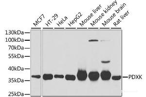 Western blot analysis of extracts of various cell lines using PDXK Polyclonal Antibody at dilution of 1:1000. (PDXK antibody)
