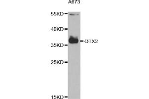 Western blot analysis of extracts of A-673 cells, using OTX2 antibody (ABIN5973188) at 1/1000 dilution. (OTX2 antibody)