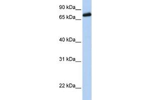 Western Blotting (WB) image for anti-Leucine-Rich Repeats and Calponin Homology (CH) Domain Containing 4 (LRCH4) (Middle Region) antibody (ABIN2782169)