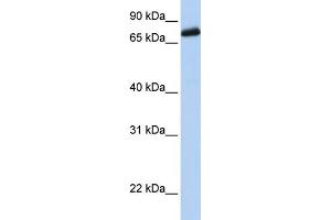 WB Suggested Anti-LRCH4 Antibody Titration:  0. (LRCH4 antibody  (Middle Region))
