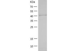 Western Blotting (WB) image for Sal-Like 4 (SALL4) (AA 1-300) protein (His tag) (ABIN7283188) (SALL4 Protein (AA 1-300) (His tag))