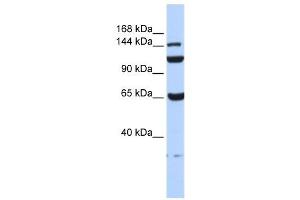 C17ORF57 antibody used at 1 ug/ml to detect target protein. (C17orf57 antibody  (N-Term))