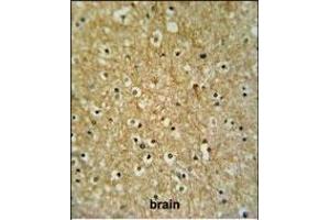 CIRH1A Antibody (N-term) (ABIN653909 and ABIN2843146) IHC analysis in formalin fixed and paraffin embedded brain tissue followed by peroxidase conjugation of the secondary antibody and DAB staining.