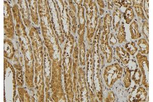 ABIN6278445 at 1/100 staining Mouse kidney tissue by IHC-P. (DEFa3 antibody  (Internal Region))