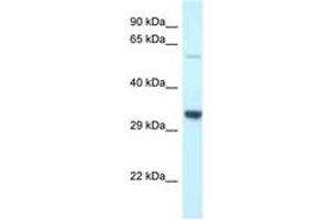 Image no. 1 for anti-Transmembrane Protein 117 (TMEM117) (AA 299-348) antibody (ABIN6747666) (TMEM117 antibody  (AA 299-348))