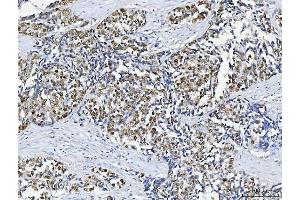 IHC analysis of ABL2 using anti-ABL2 antibody (ABIN4886412). (ABL2 antibody  (AA 1065-1182))
