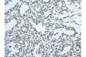 Rabbit Anti-NIP7 antibody   Paraffin Embedded Tissue: Human Lung cell Cellular Data: alveolar cell of renal tubule Antibody Concentration: 4. (NIP7 antibody  (Middle Region))