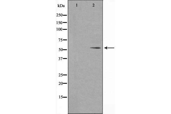 FOXC1 antibody