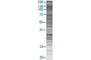 PPP1R3C transfected lysate. (PPP1R3C 293T Cell Transient Overexpression Lysate(Denatured))
