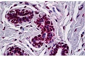Human Breast: Formalin-Fixed, Paraffin-Embedded (FFPE) (RUNX1 antibody  (AA 210-311))