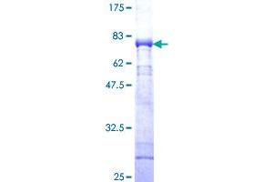 Image no. 1 for Calcium/calmodulin-Dependent Protein Kinase I (CAMK1) (AA 1-370) protein (GST tag) (ABIN1347913) (CAMK1 Protein (AA 1-370) (GST tag))