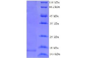 SDS-PAGE (SDS) image for LECS (AA 1-111), (full length) protein (His tag) (ABIN5710792)
