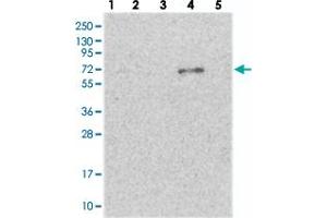 Western blot analysis of Lane 1: RT-4, Lane 2: U-251 MG, Lane 3: Human Plasma, Lane 4: Liver, Lane 5: Tonsil with ETFDH polyclonal antibody . (ETFDH antibody)
