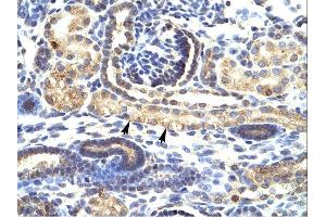IHC Suggested Anti-SNAI1 Antibody Titration: 4-8ug/mlTissue: Human Kidney, epithelial cells of renal tube (indicated with arrows)Magnification:400X