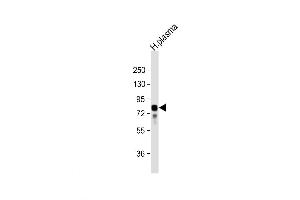 Western Blot at 1:32000 dilution + human plasma lysate Lysates/proteins at 20 ug per lane. (Vitronectin antibody  (N-Term))